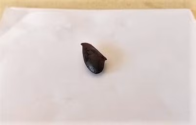 Hạt Hồng xiêm được gắp ra khỏi phổi trái của bệnh nhân sau 1 năm mắc kẹt. Ảnh: suckhoedoisong
