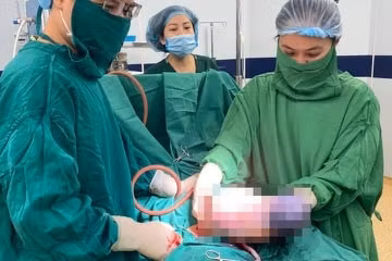 Một bé còn nguyên trong bọc ối sau sinh (Ảnh: BVCC)