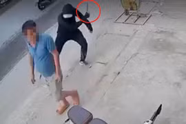 Công an truy nã đối tượng chém lìa chân người đàn ông ở Hà Nội