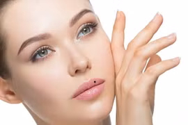 Nốt ruồi ở môi nói lên điều gì? Tốt hay xấu