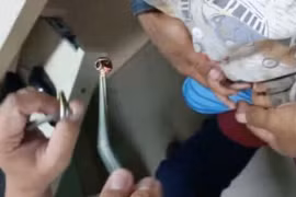 Kon Tum: Phát hiện con vắt dài 6cm trong khoang mũi bệnh nhi 10 tháng tuổi