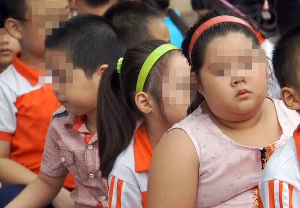 Tình trạng trẻ em béo phì tại Việt Nam gia tăng nhanh. Ảnh minh họa
