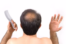 Chữa bệnh hói đầu bằng cách sử dụng da nhân tạo được “nuôi”