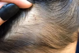 Trung Quốc: Giáo viên mầm non ngược đãi, đâm kim vào đầu và người trẻ