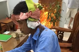 Điều tra vụ 2 nhân viên trạm thu phí bị hành hung vỡ đầu ở Khánh Hòa