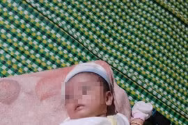 Bình Phước: Xôn xao nghi vấn người cha đá con 2 tháng tuổi gãy chân