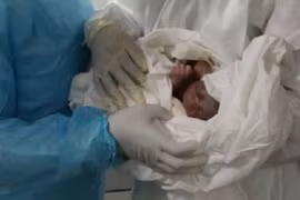 Một bệnh nhân nhiễm virus Corona sinh con thành công tại Cameroon