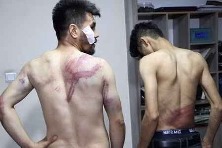 hai nha bao afghanistan bi danh dap trong trai giam cua taliban hinh 1