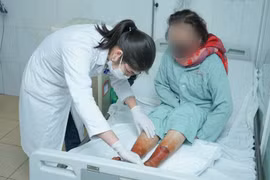 Ngâm chân bằng bột lá không rõ nguồn gốc, một phụ nữ suýt hoại tử hai chân