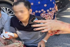 Chủ tịch công ty thuê giang hồ chém cổ đông để thâu tóm doanh nghiệp