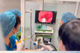 Lào Cai: Nội soi đưa con đỉa dài gần 8 cm ra khỏi khí quản bệnh nhân