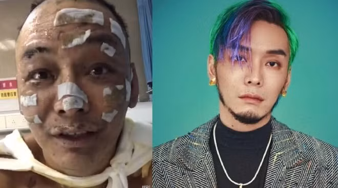 Người hâm mộ Cbiz vô cùng lo lắng trước thông tin nam rapper Từ Chân Chân gặp hoả hoạn thương tâm.
