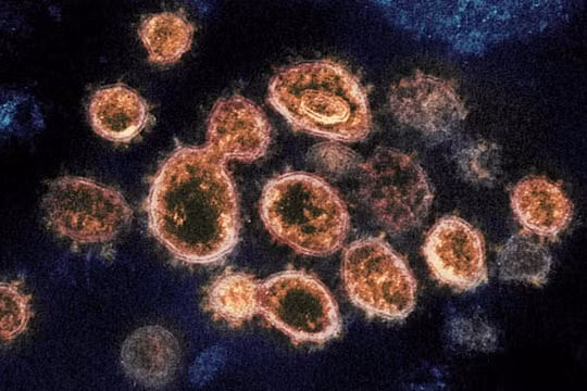Virus Corona có thể biến đổi chức năng tế bào tuyến tụy, tăng nguy cơ bệnh tiểu đường