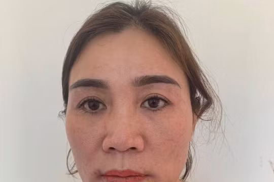 Bị phát hiện khi đang giao dịch ma túy, 'nữ quái' nuốt cả gói ma túy vào bụng