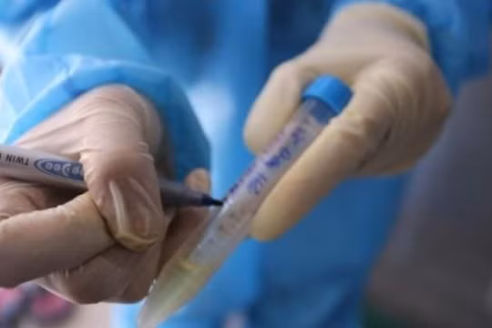 308 mẫu xét nghiệm Covid-19 của công nhân Nhà máy khí điện đạm Cà Mau đều âm tính