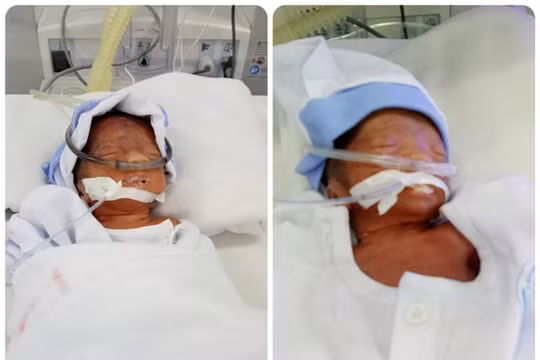 An Giang: Cách ly xã hội, Thượng úy Công an phường dùng xe chuyên dụng đưa sản phụ đi sinh