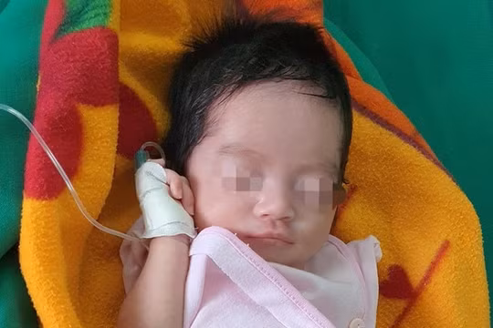 Nghệ An: Phẫu thuật thành công cho bé sơ sinh có đường ruột nằm ngoài ổ bụng