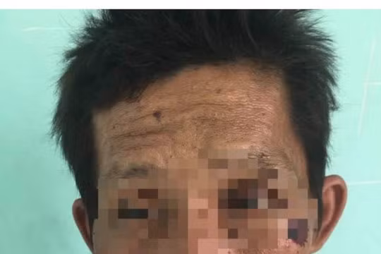 Đã bắt được nghi phạm gây cháy chi nhánh ngân hàng ở Kiên Giang