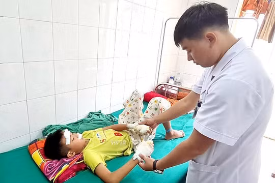Bé trai 13 tuổi bị rách giác mạc, dập 2 bàn tay do cục pin phát nổ