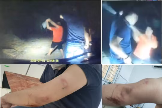 Hà Tĩnh: Một nhà báo bị hành hung khi đi xác minh 'đất tặc'
