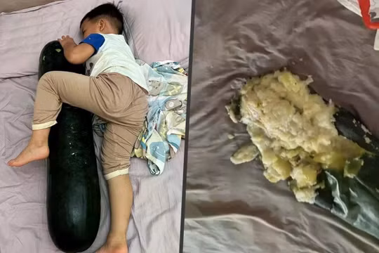 Chuyên gia Trung Quốc cảnh báo trào lưu ôm bí đao khi ngủ để giải nhiệt