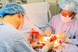 Nối thành công bàn tay người đàn ông bị đứt lìa do cưa xẻ gỗ