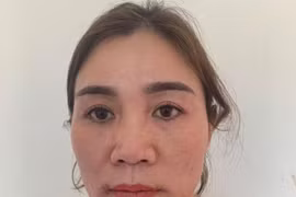 Bị phát hiện khi đang giao dịch ma túy, 'nữ quái' nuốt cả gói ma túy vào bụng
