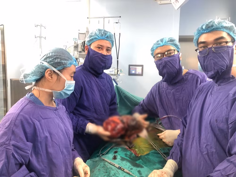 phau thuat thanh cong cat khoi u than nang 2kg hinh 1