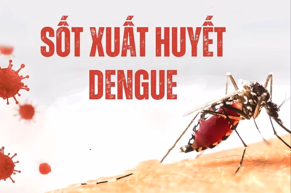 sot-xuat-huyet(1).jpg
