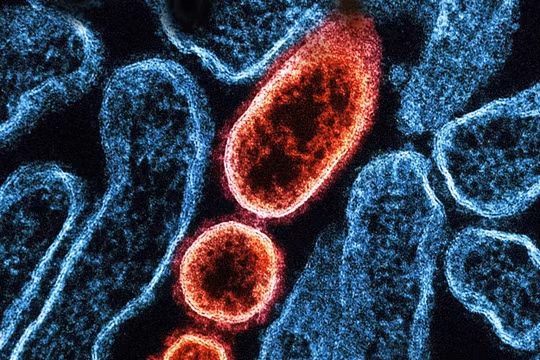 Ấn Độ khẳng định đã kiểm soát được dịch Nipah