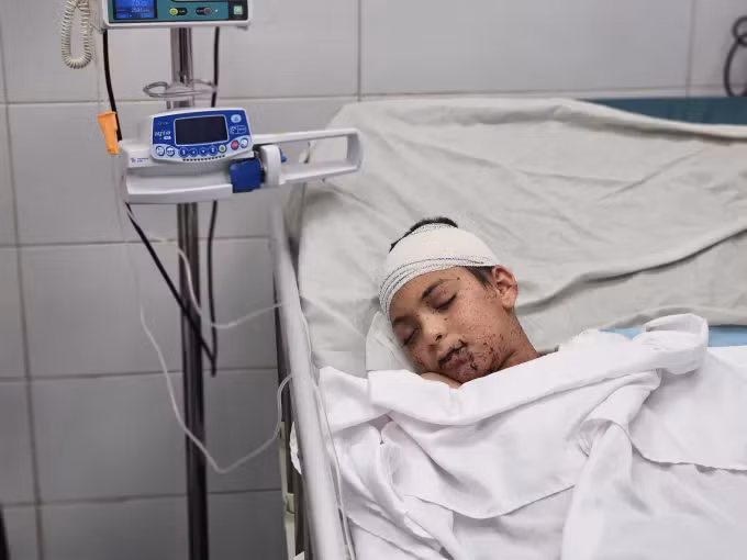 Đứa con duy nhất còn sống của bác sĩ Alaa al-Najjar cũng đang bị thương nặng. Ảnh: Hani Alshaer/Anadolu