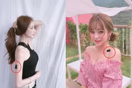 Vết bớt trên cơ thể tiết lộ gì về vận mệnh tương lai mỗi người?