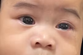 Hệ lụy khôn lường nếu dùng lá cây chữa đau mắt đỏ