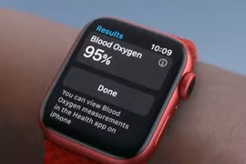 Apple Watch X sắp được công bố