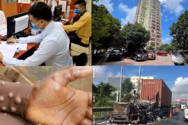 Nóng 18h: TP.HCM phát hiện vài ca đậu mùa khỉ trong hai tuần, có đáng lo?