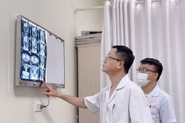 Khi đau ở vùng thắt lưng kéo dài, dấu hiệu của bệnh ung thư nào?