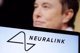 Mỹ điều tra công ty Neuralink của Elon Musk về mầm bệnh nguy hiểm