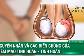 Bác sĩ tiết lộ lý do bệnh lý khiến nhiều quý ông suy giảm chức năng đàn ông