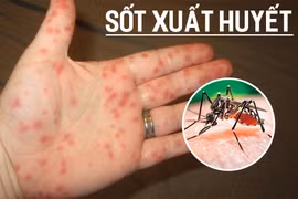 Dịch sốt xuất huyết đang tăng cao, tỉ lệ tử vong như thế nào?