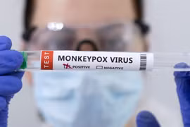 WHO tuyên bố bệnh mpox không còn là tình trạng khẩn cấp về sức khỏe cộng đồng