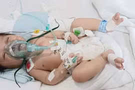 Nghị lực sống mãnh liệt của bé trai 2 tháng tuổi bị mắc bệnh tim bẩm sinh