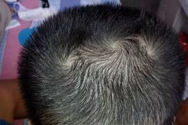 Xem tướng xoáy tóc trên đầu đoán vận mệnh, tính cách