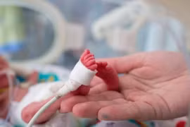 Bệnh viện Phụ sản Hà Nội: Cứu sống thành công bé gái sinh non nặng 400g