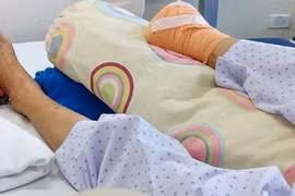 Dùng kim chích vết thương để tự nặn mủ, người phụ nữ phải cắt cụt bàn chân