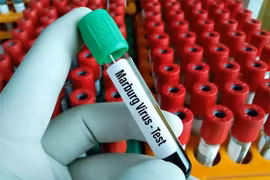 Ngành y tế TPHCM khuyến cáo người dân cảnh giác với virus Marburg