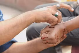 Bệnh nhi nhiễm khuẩn huyết tử vong do người nhà “chữa mẹo” bằng cách rạch dao lam trên cơ thể