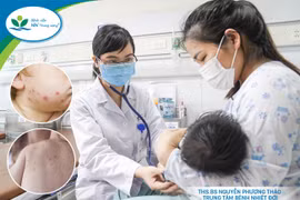 Bệnh thủy đậu vào mùa, cha mẹ không được chủ quan!