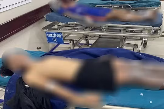 Quảng Bình: 4 thiếu niên bỏng nặng vì chế tạo pháo theo hướng dẫn trên mạng