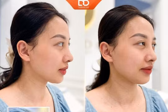 Bí quyết cho nhan sắc rạng ngời - Làm đẹp toàn diện cùng Thẩm mỹ DrD 