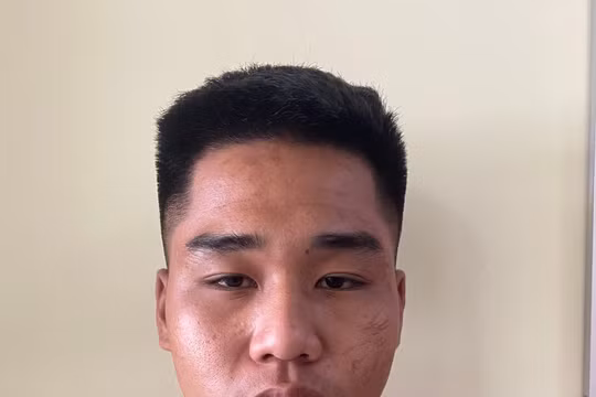 Vụ người phụ nữ thuê giang hồ chém chủ nợ dằn mặt ở Gia Lai: Bắt giữ thêm 1 nghi phạm